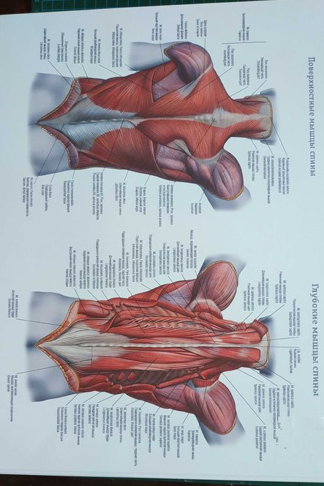 Триггерные точки, анатомия постеры/плакаты