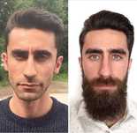 Minoxidi kirkland! Crescimento barba e cabelo