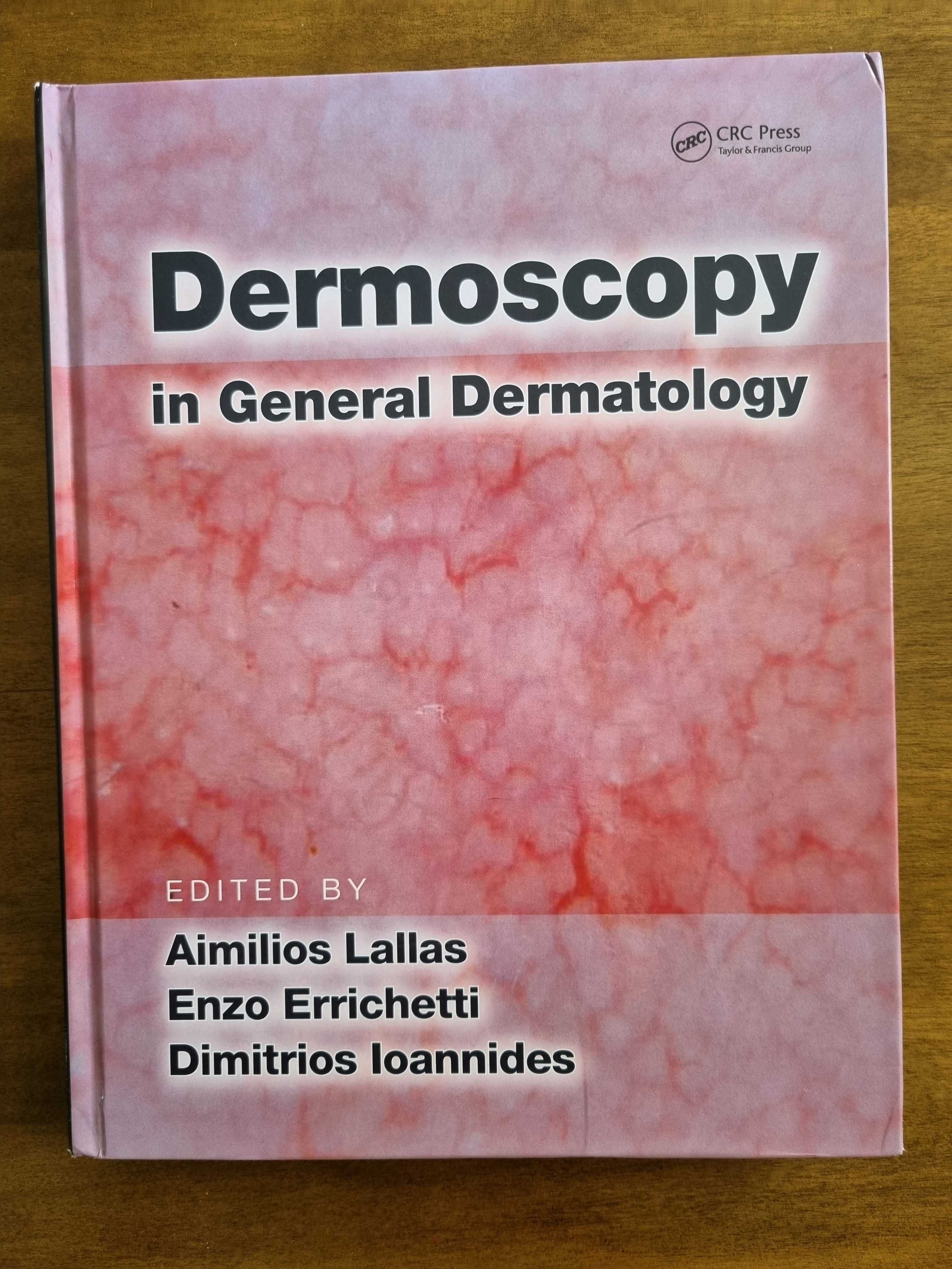 Nowa książka "Dermoscopy in general dermatology" Lallas Dermatoskopia