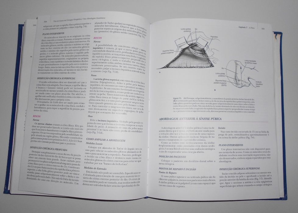 Manual Vias de acesso em cirurgia ortopédica - stanley Hoppenfield