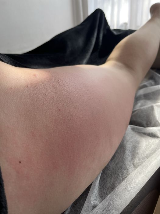 Пресотерапія, ліпопластика, лімфодренаж, кавітація  , масаж