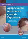 Артроскопія плечового суглоба Гарцмана  2019 р.