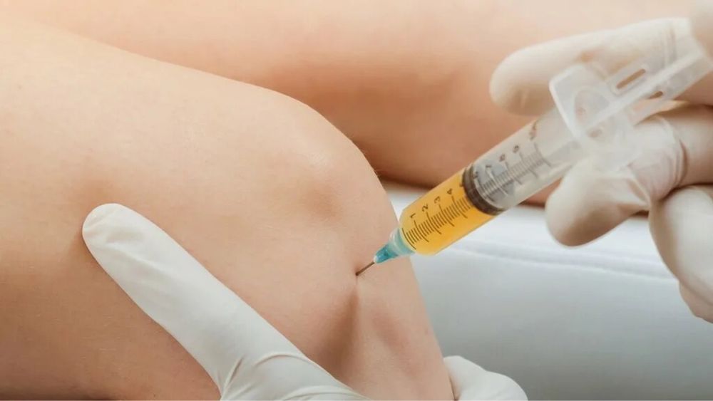 Массаж. Иглотерапия / Акупунктура. Медицинский плазмолифтинг