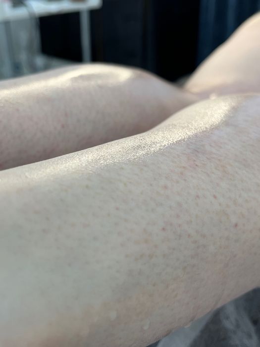 Чоловіча депіляція,шугаринг,віск,електроепіляція,лазерна епіляція Київ