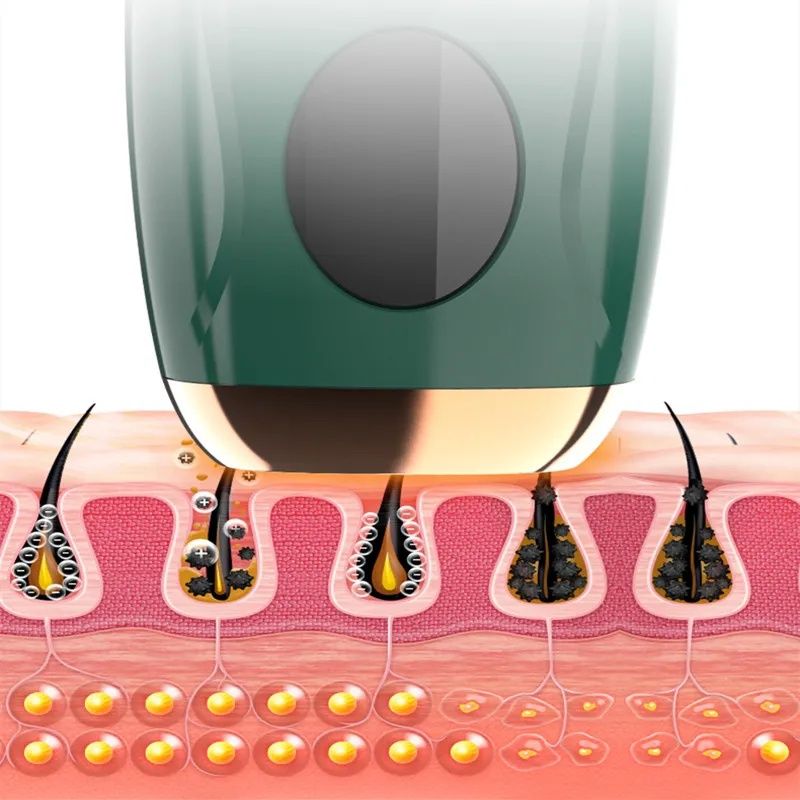 Dispositivo de Depilação a Laser Multifuncional Tmy-002 NOVO