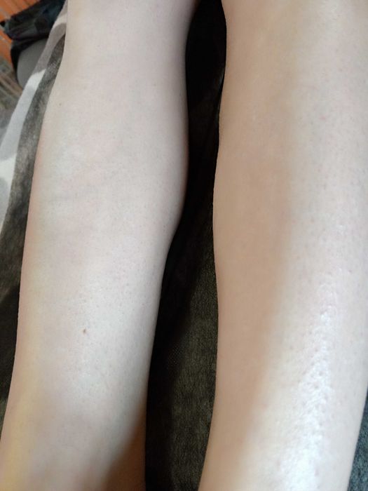 Воскова депіляція/Мікронідлінг/Мезотерапія/Вакуумно-роликовий масаж