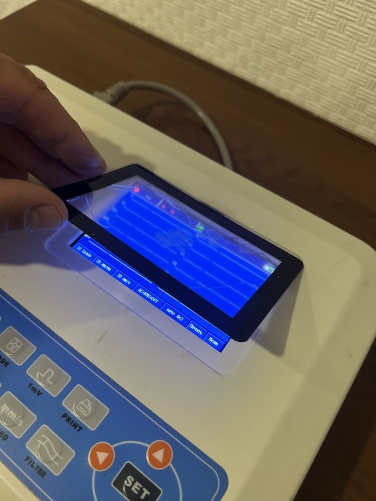 Кардіограф Електрокардіограф ECG300G LCD
