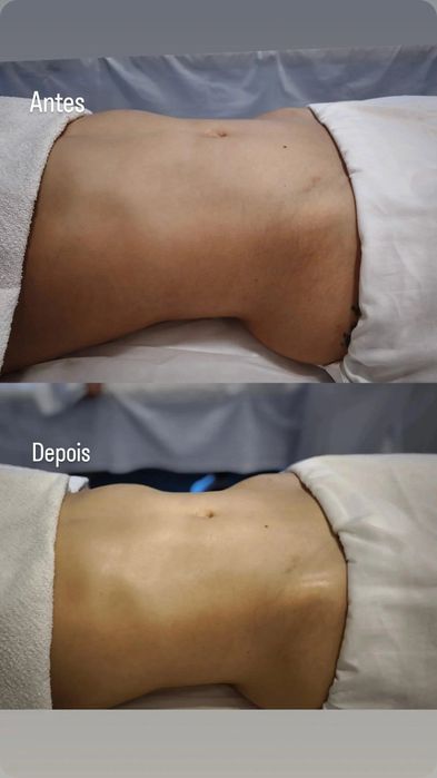 Pestanas, sobrancelhas, Extensão de Unhas, gelinho e drenagem linfátic