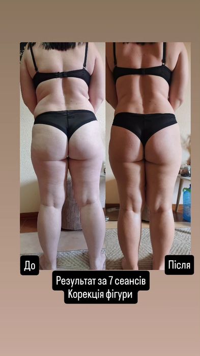 Навчання з масажу