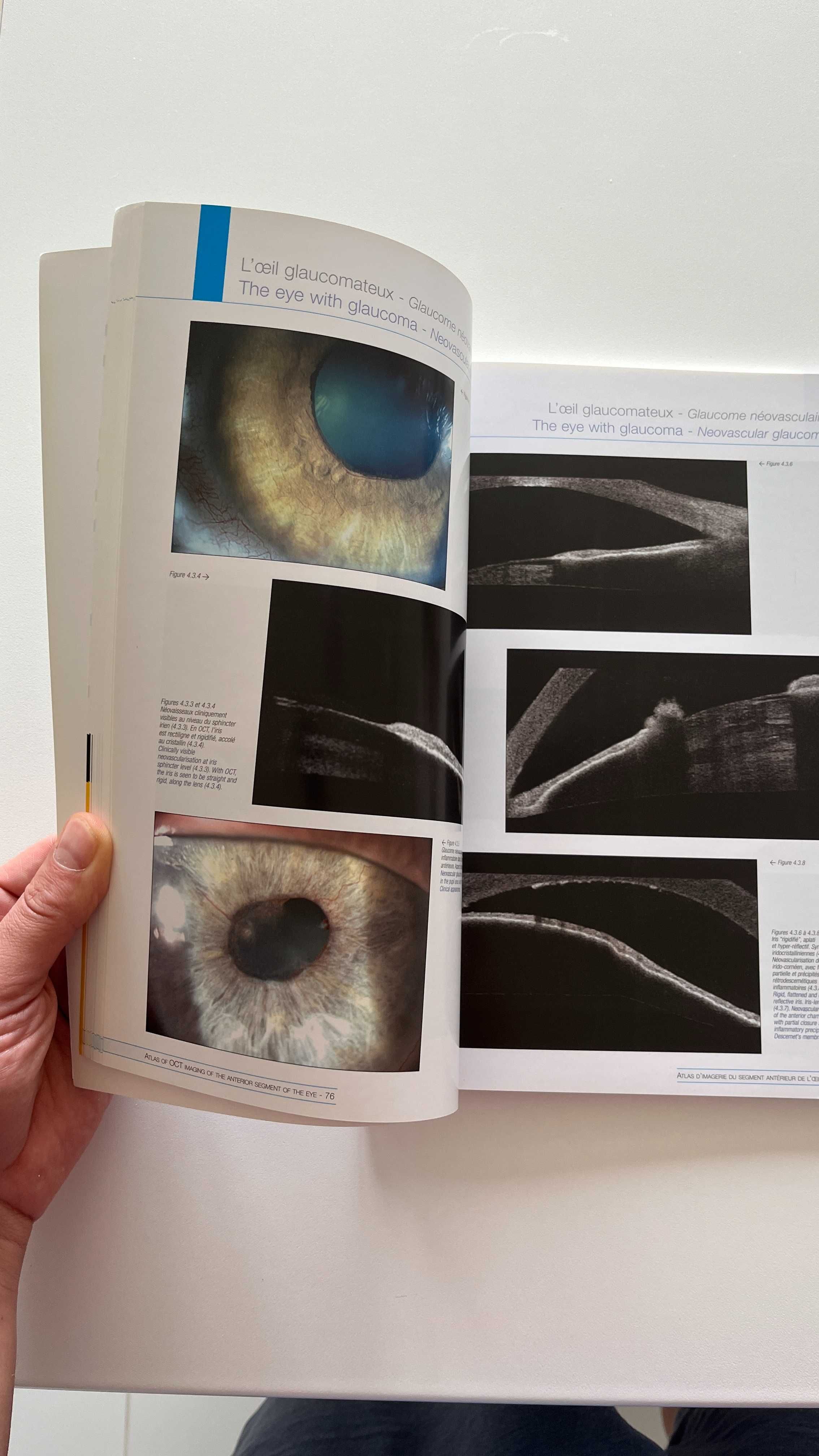 Atlas d'imagerie du segment anteriueur de loeil en OCT