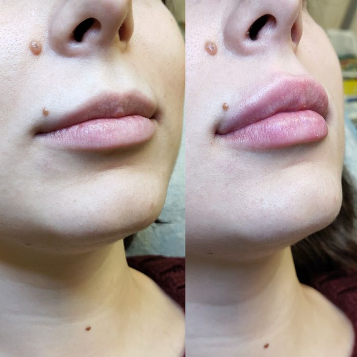 Косметолог Чистка лица Днепр Пр. Поля