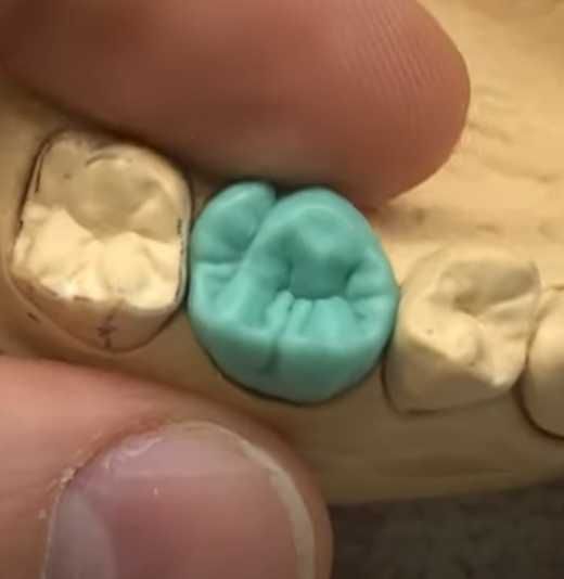 Зубной Техник . Зуботехническая Лаборатория .  МК .ЦИРКОН .