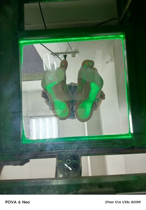 Ортопедичні устілки індивідуального виготовлення