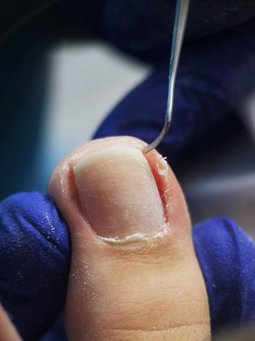 Подолог Мукачево,педикюр Мукачево