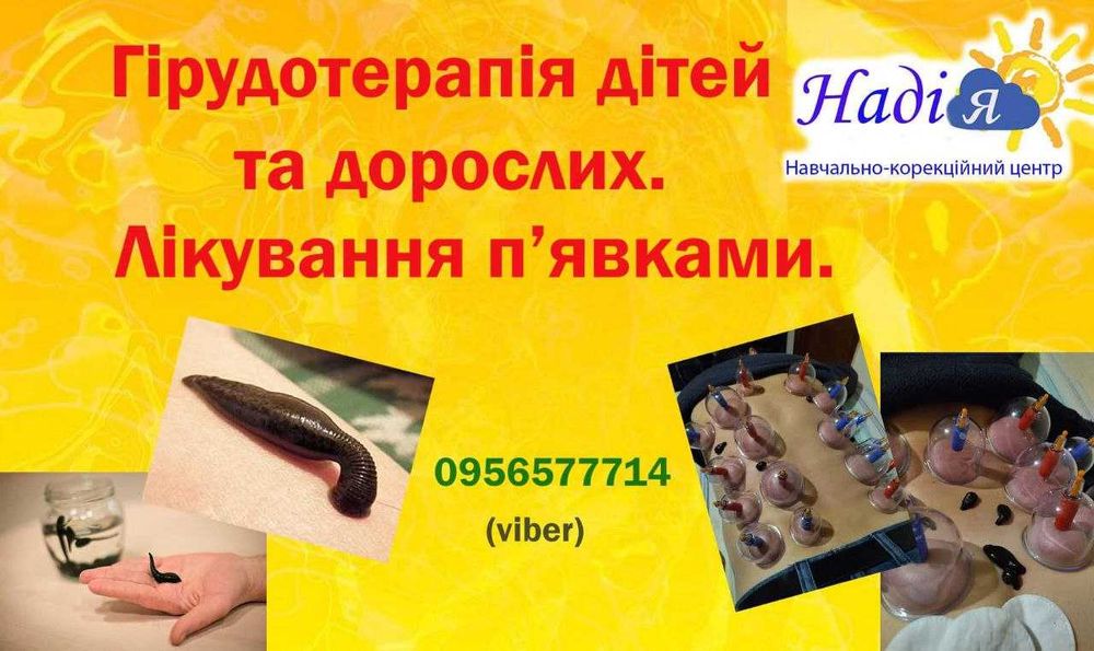 Гірудотерапія(п'явки) Тополя, Придніпровськ