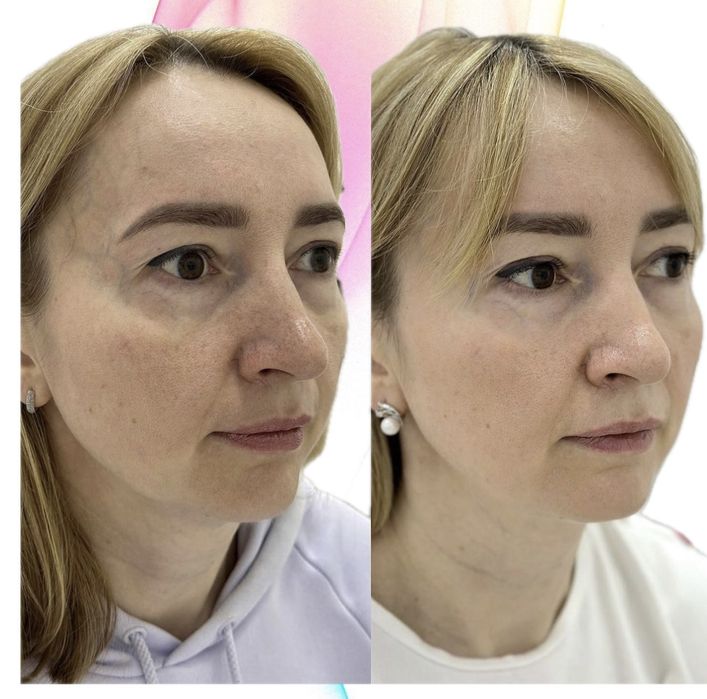 Косметолог, чистка, ін'экції, апаратні процедури, массаж