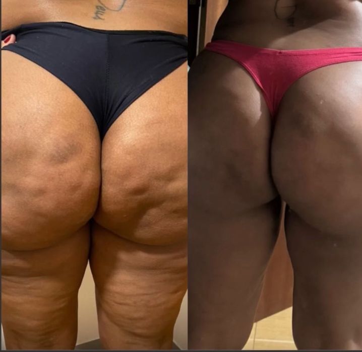 Massagem corporal Redutora