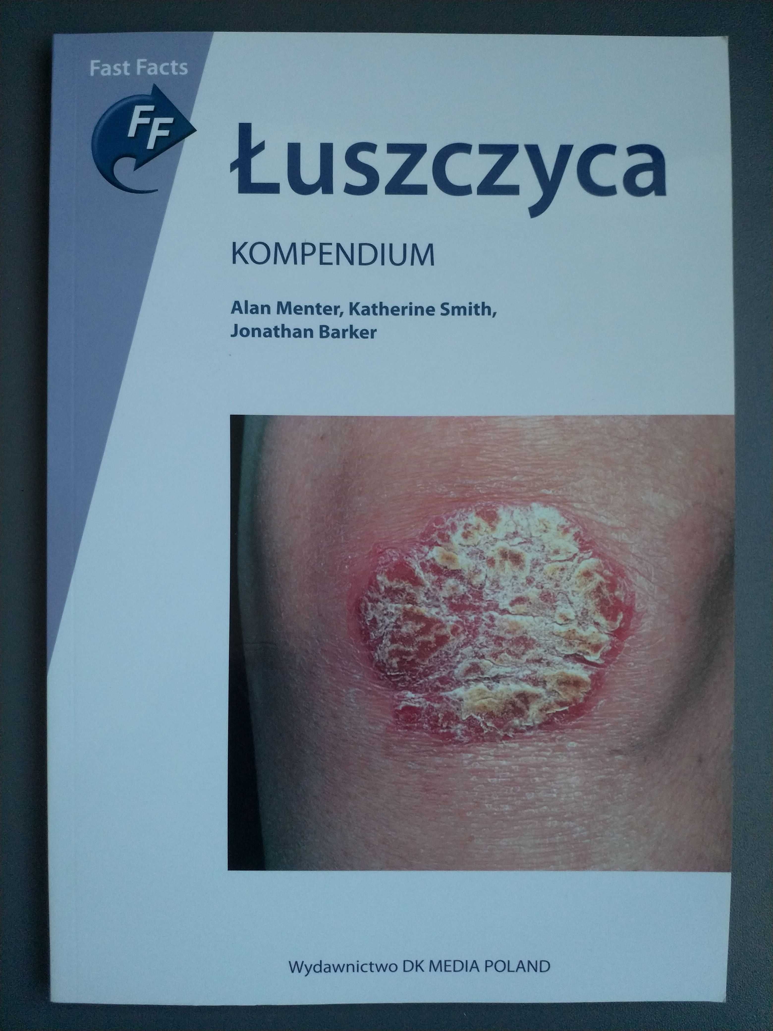 Łuszczyca. Kompendium A. Menter J. Barker K. Smith