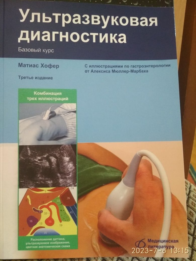 В.В. Митьков. Практическое руководство по УЗИ.