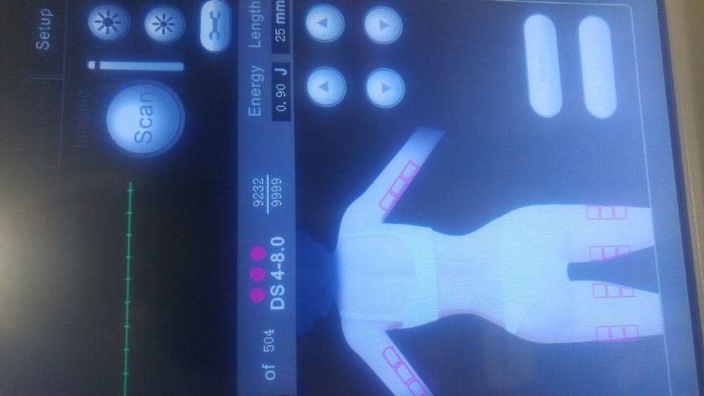 Hifu hifu skalpel bez skalpela likwidacjia salonu