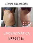 Redução de gordura localizada