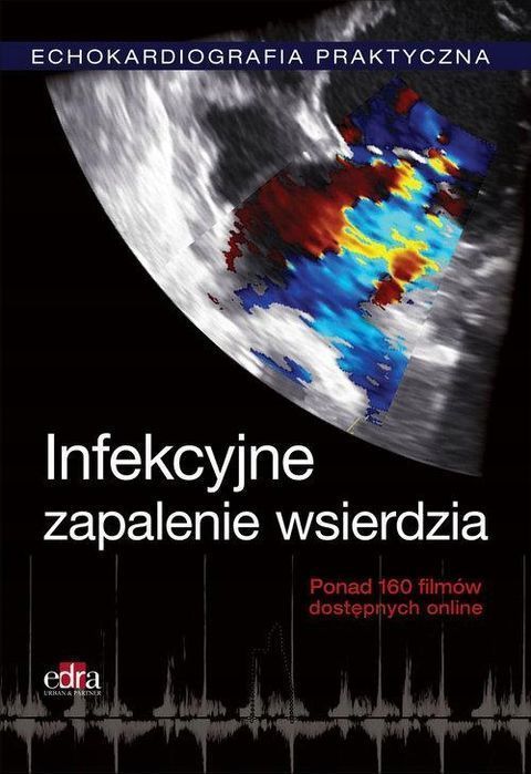 Echokardiografia Praktyczna Infekcyjne...