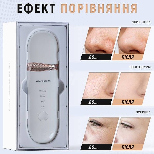 Ультразвуковий скрабер