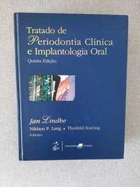 Tratado de Perioldontologia Clínica e Implantologia Oral