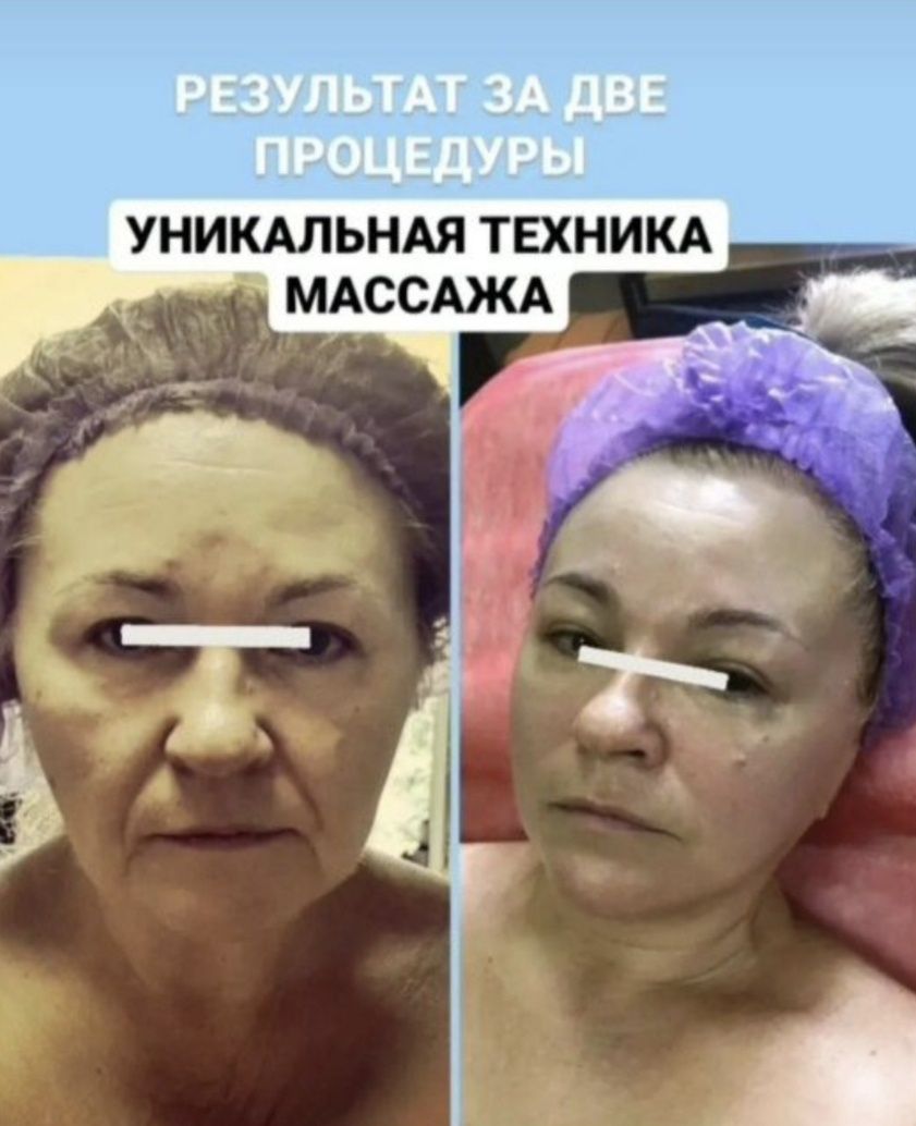 Масаж обличчя 3 техніки в одному масажі, міофасціальний, моделюючий, л