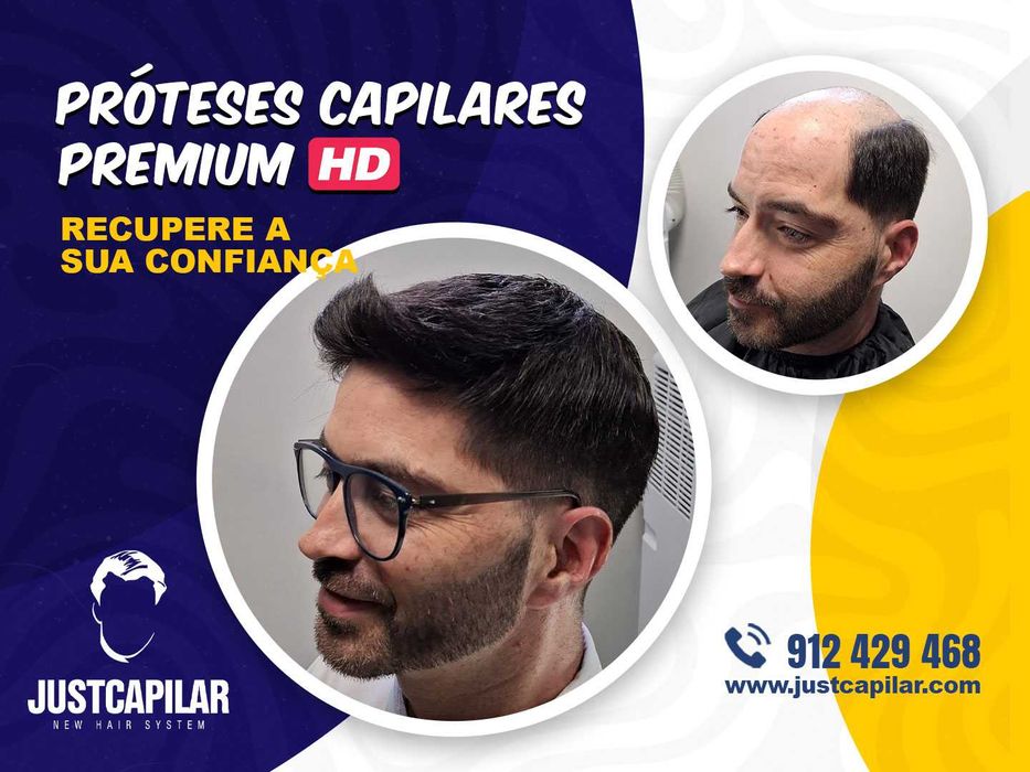 Prótese capilar Micro pele com colocação e corte, efeito real!