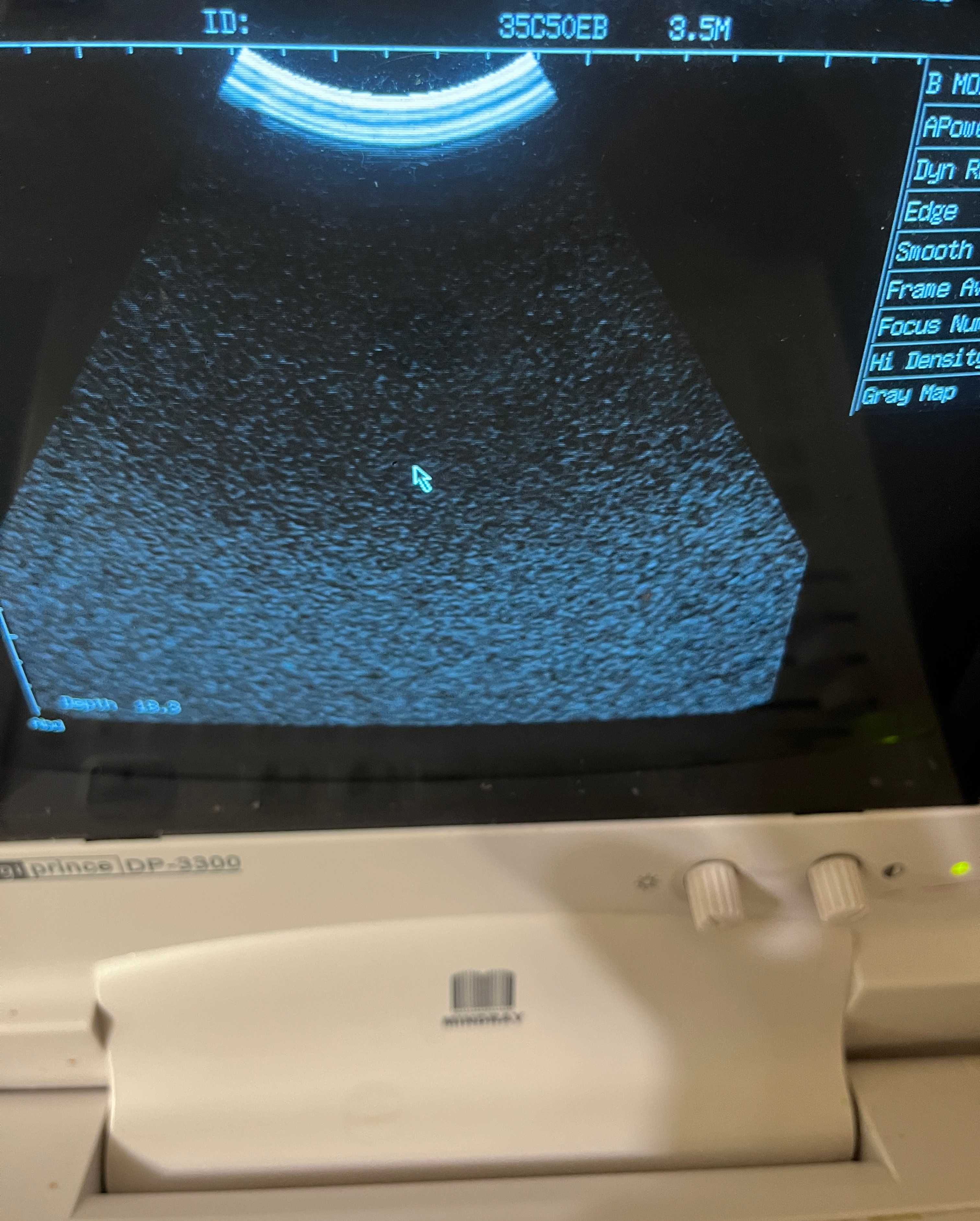 Датчик УЗД Mindray 35C50EB до  DP-3300  DP-10