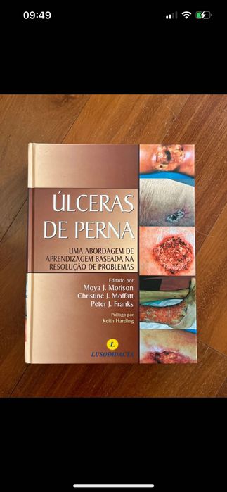 Livro Úlceras de perna