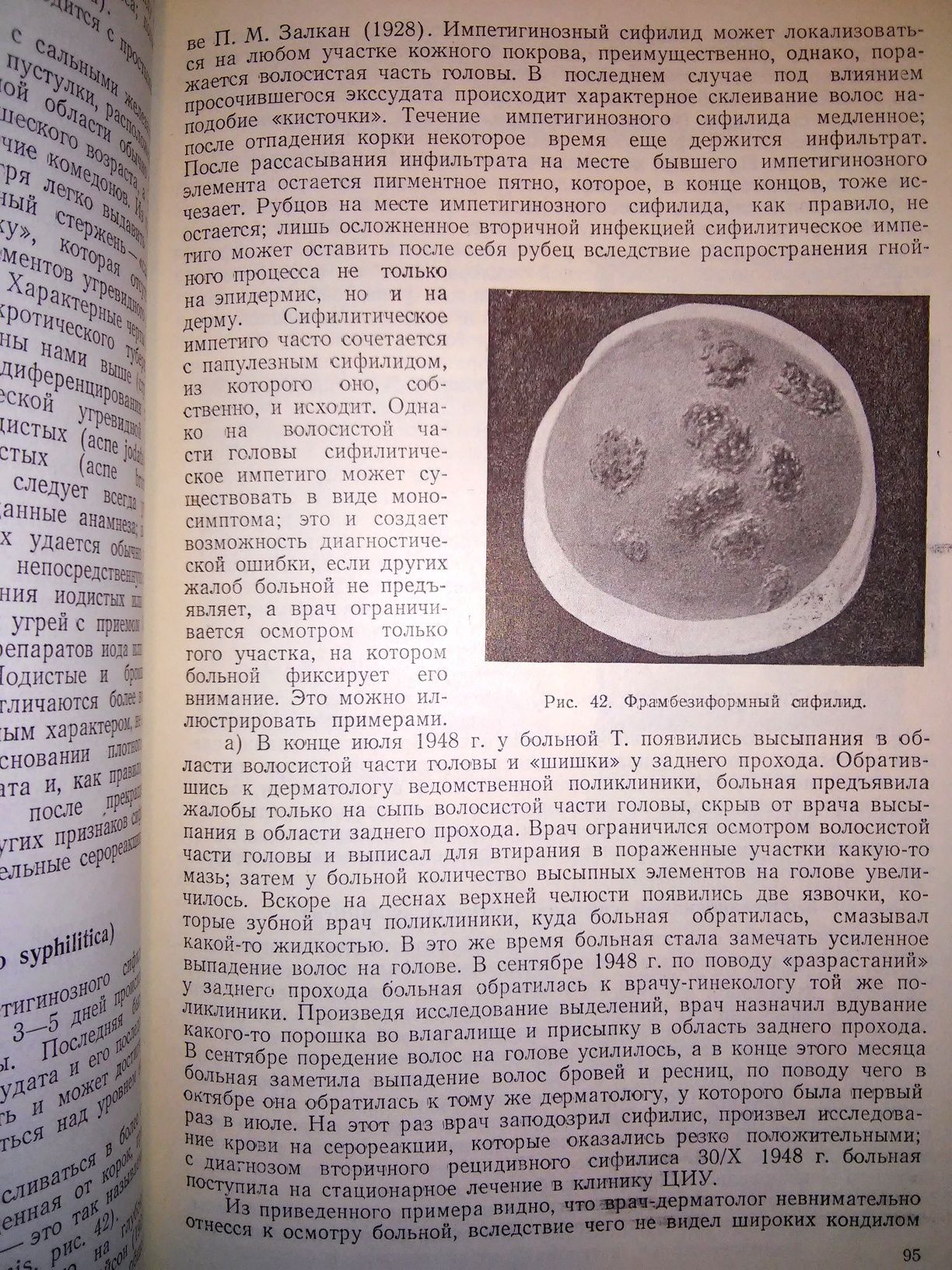 Аствацатуров Сифилис его диагностика и лечение руководство 1956