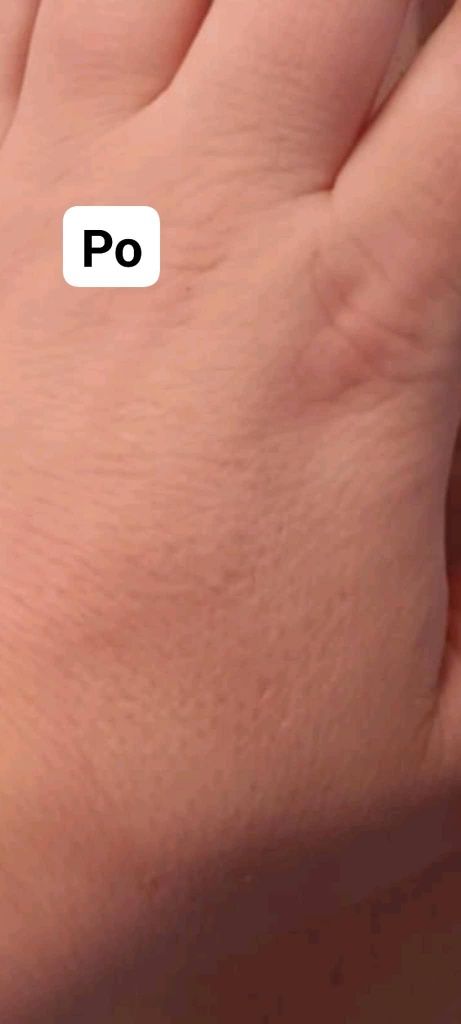 Skin Renew. Mikrodermabrazja i enzymy. Peeling twarzy