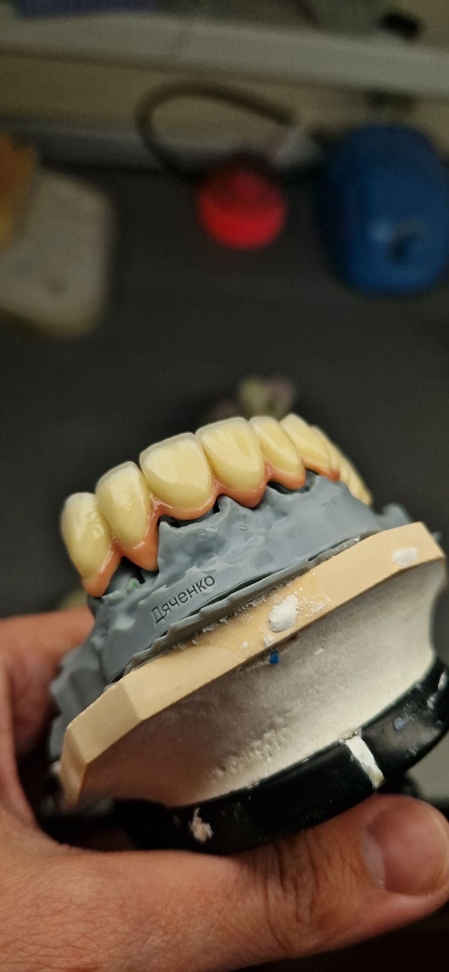 Зубний технік. Більше 8 років досвіду роботи