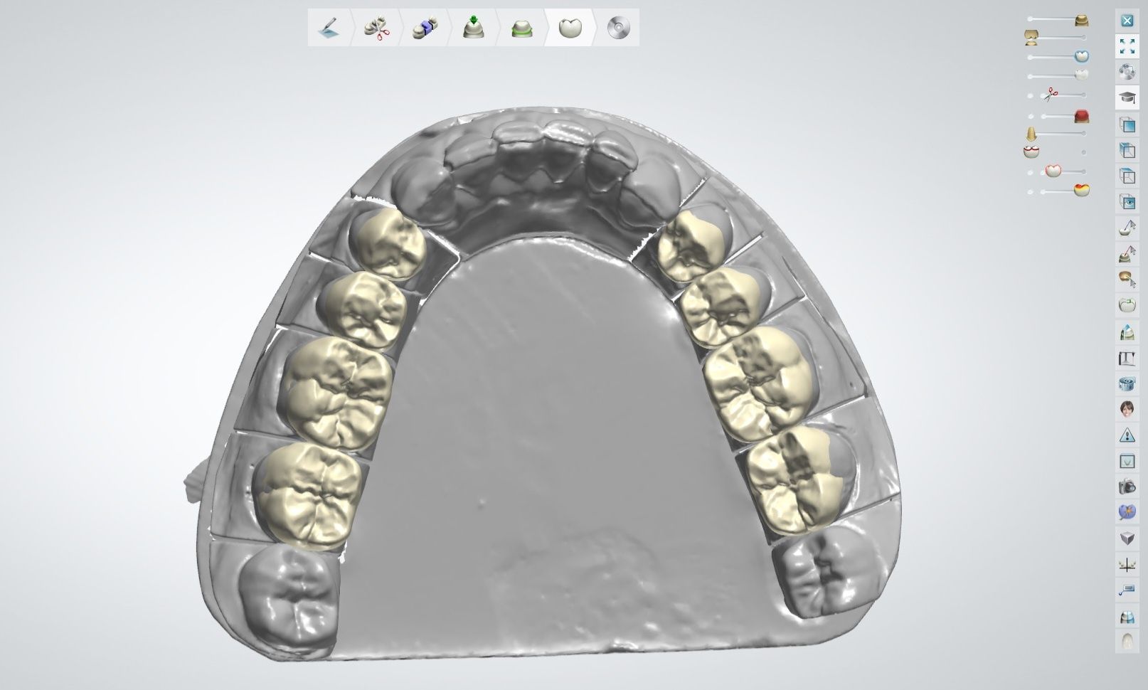 Protezy zębowe modelowanie 3shape technik dentystyczny