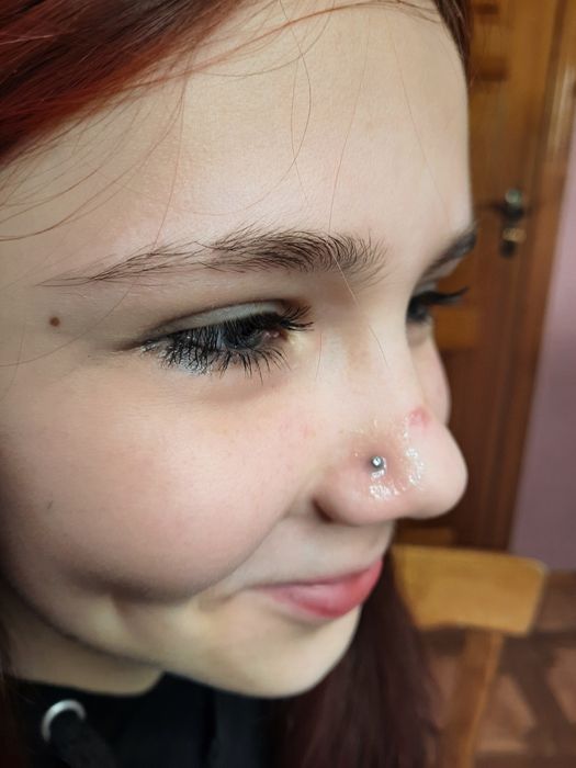 Прокол ушей бесшумной системой, крыла носа Одесская