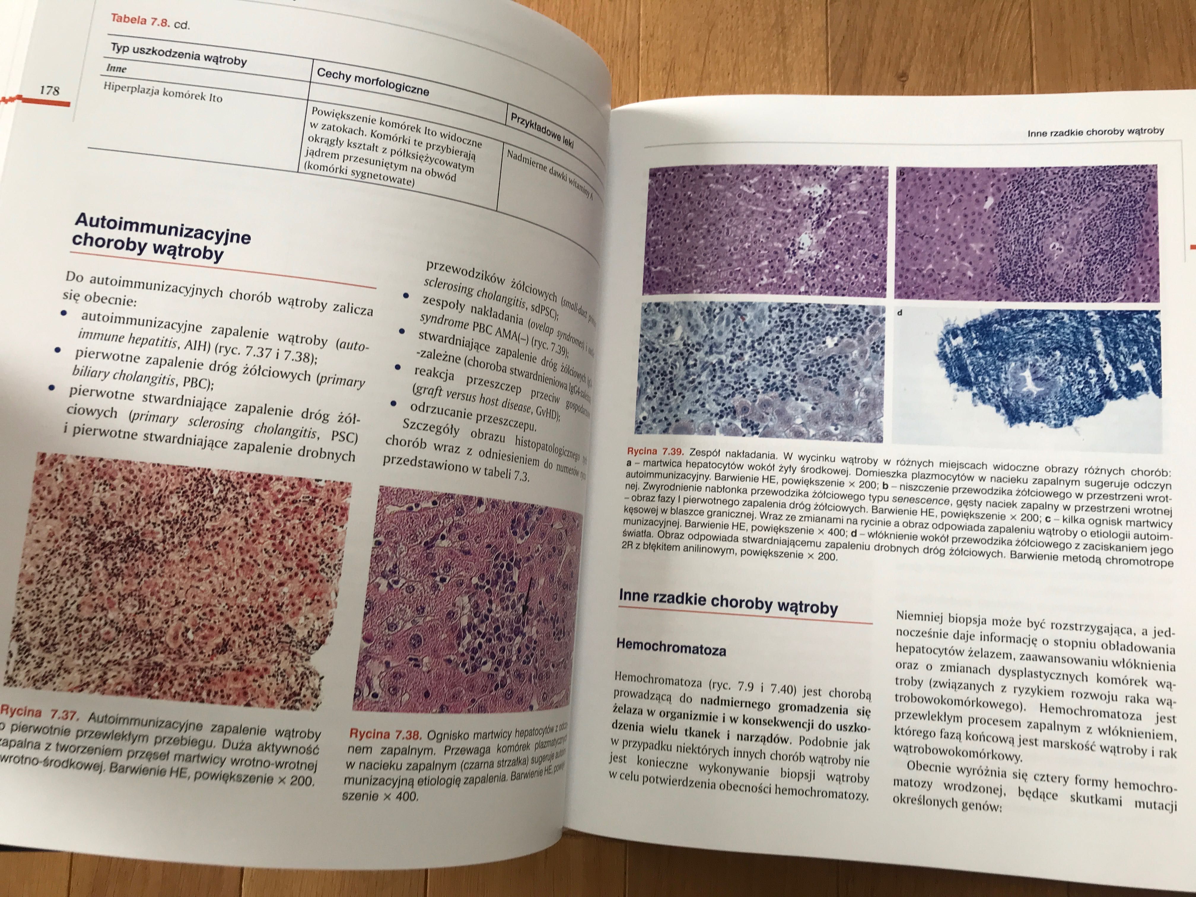 HEPATOLOGIA Tom 1 i 2 - Anatol Panasiuk