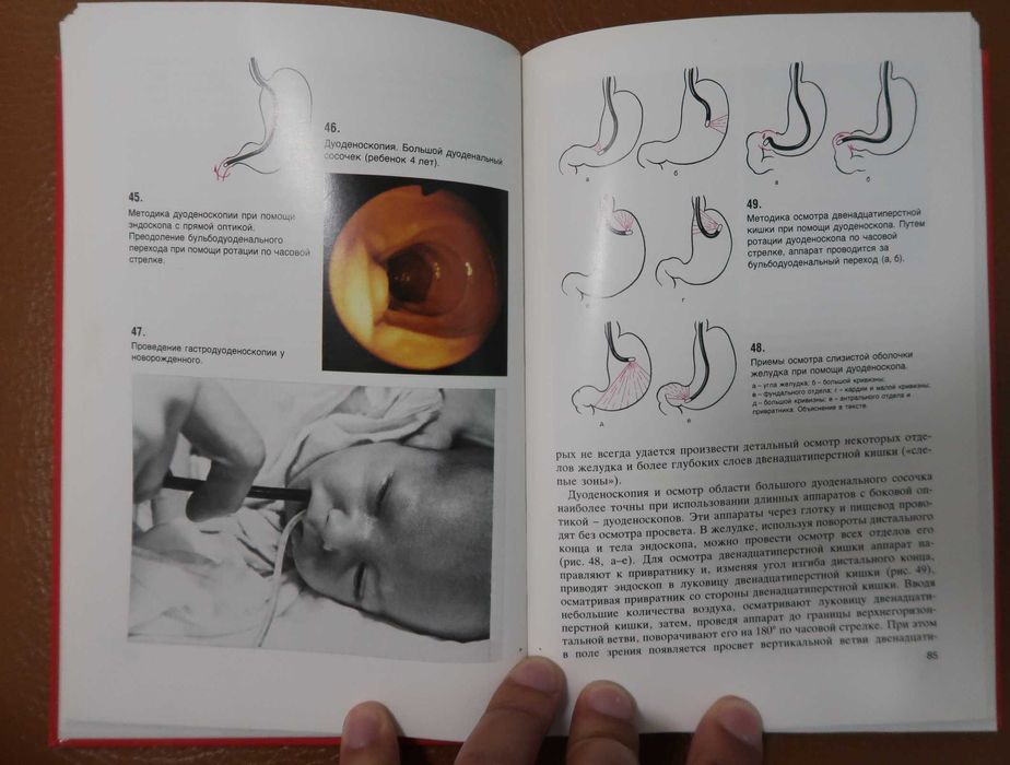 Эндоскопия учебник атлас ЖКТ Долецкий купить