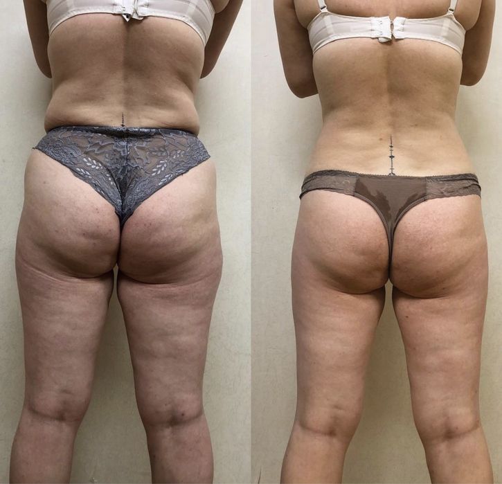 Массажист реабілітолог массаж обучение навчання курсы