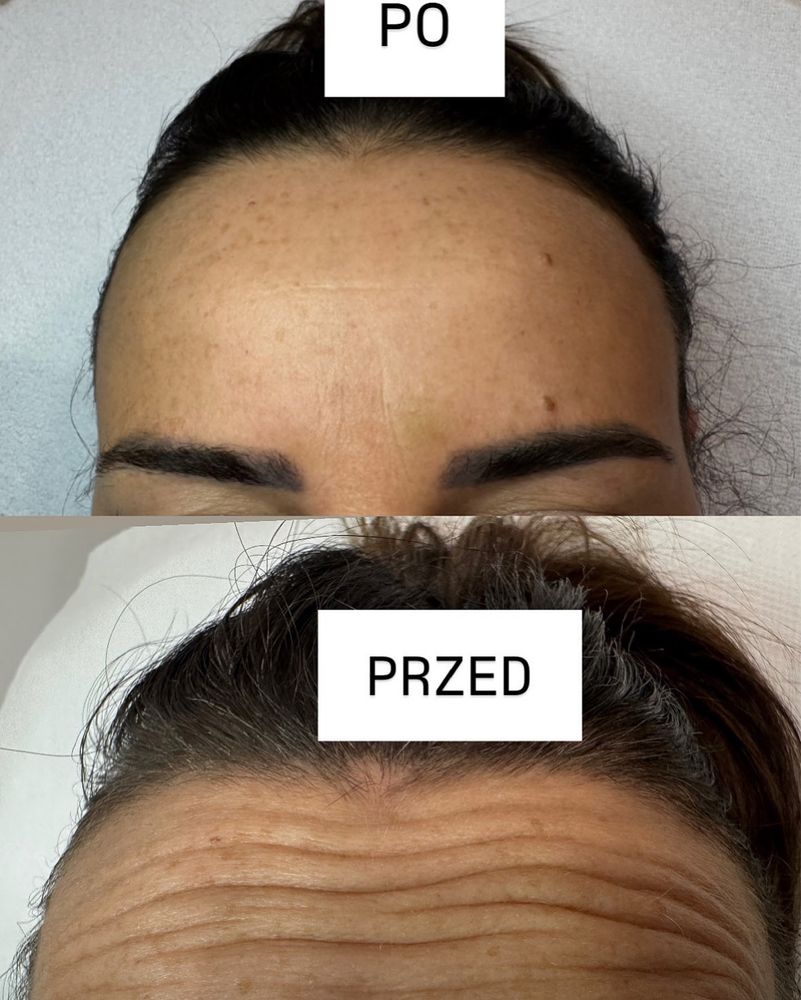 Medycyna estetyczna,przedłużanie włosów.