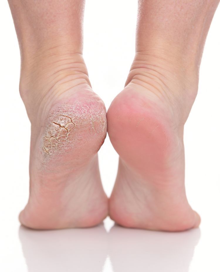Pedicure i inne zabiegi dla Panów