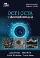 OCT I OCTA w chorobach siatkówki - Małgorzata Figurska