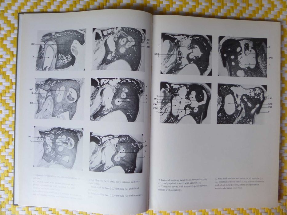 Atlas of the Histopathology of Ear Tumours
P.G. Gerlings