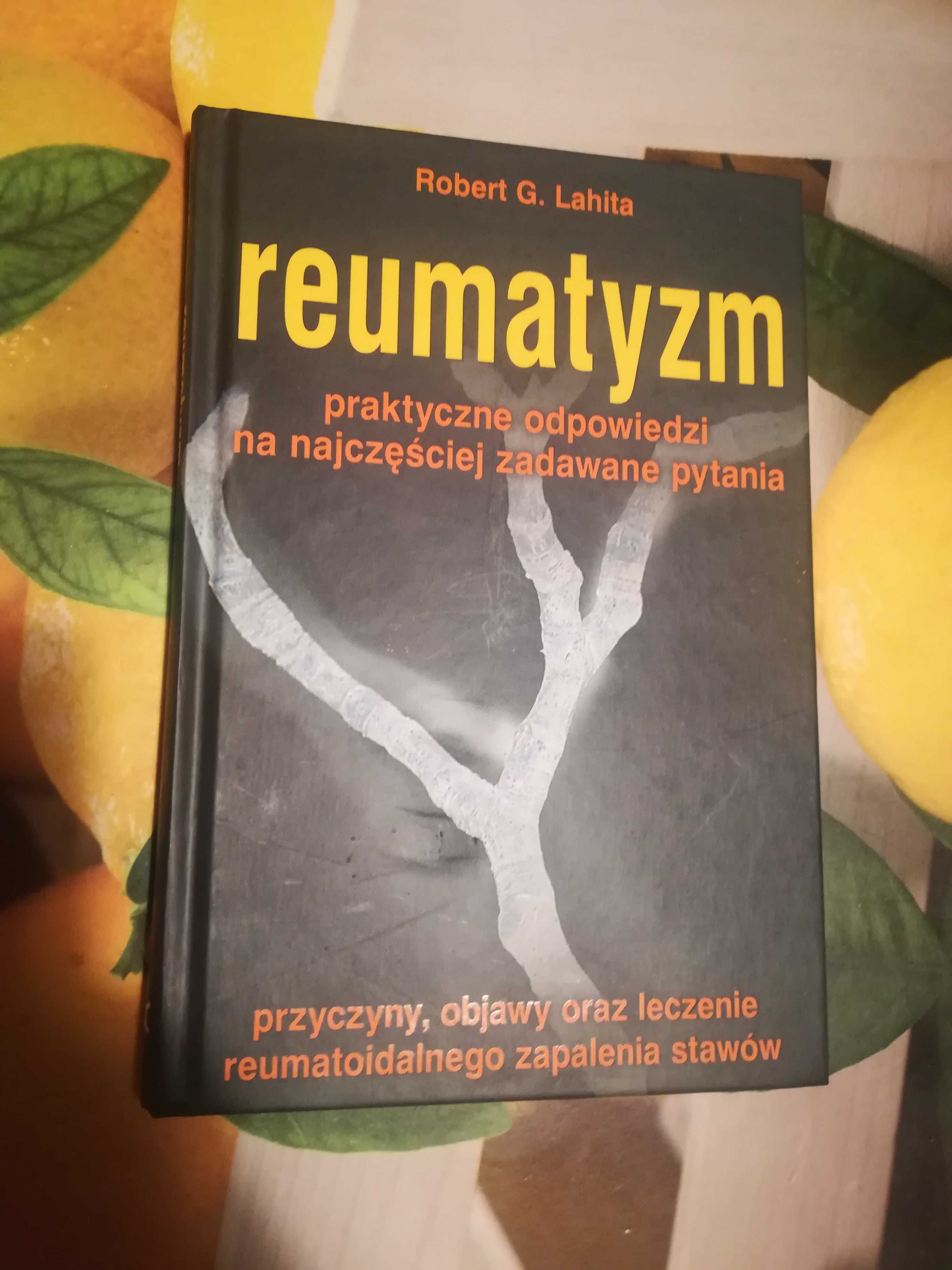 Reumatyzm praktyczne odpowiedzi poradnik