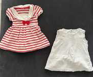 2 vestidos bebé menina