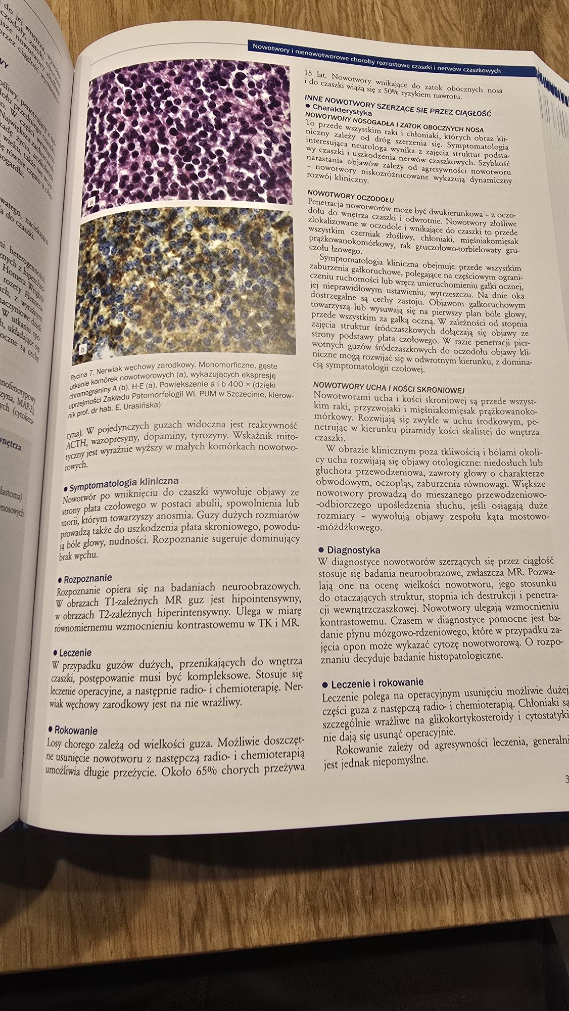 Neurologia A.Stępień tom I,II i III