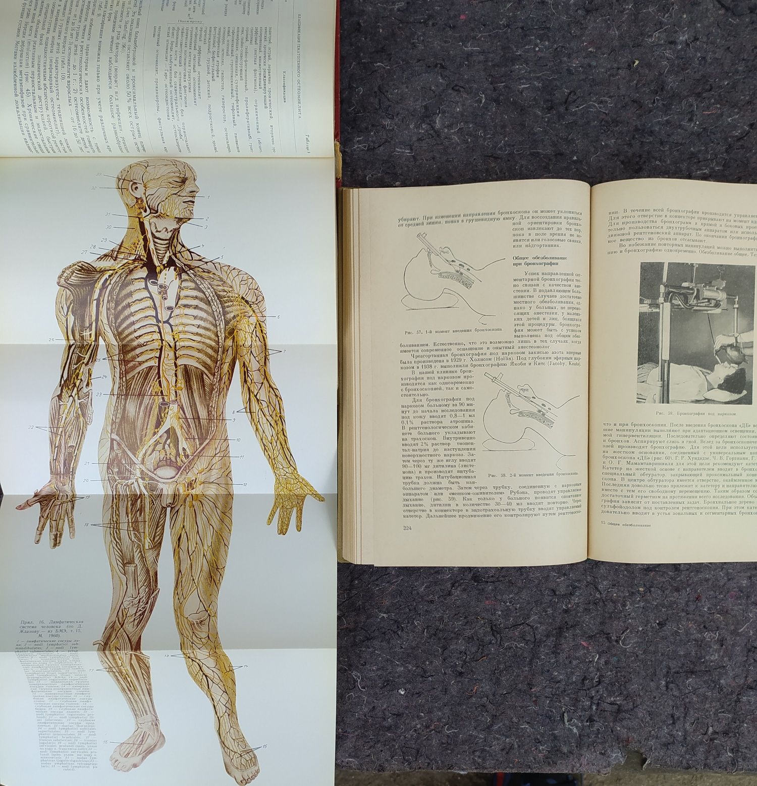 книги: Гнойно-септическая хирургия. II. 1977. Общее обезболивание 1964