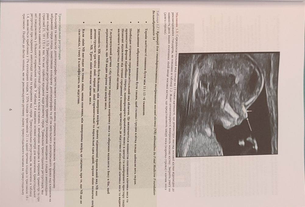 First Trimester Ultrasound Diagnosis of Fetal Abnormalities