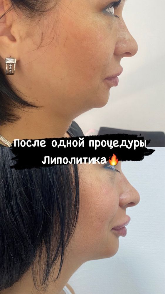 Косметолог Центр Днепр Акционные предложения